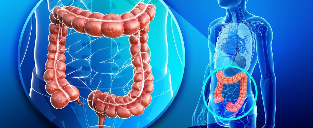 Postul cu apă și cancerul de colon